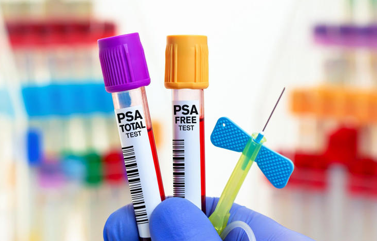 New blood test could diagnose prostate cancer more accurately.