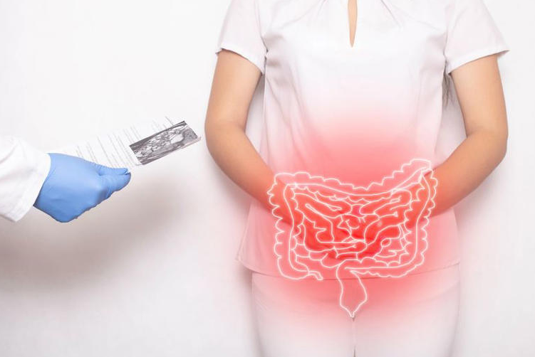 Dt Amir Kahn issues bowel cancer alert to young people - seven warning signs.